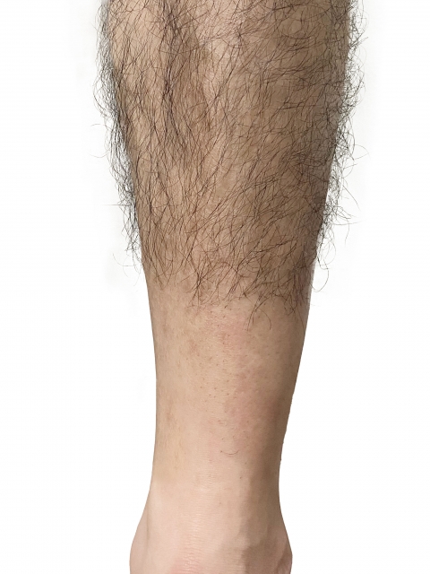 脱毛した男性の足